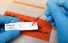 KHI NÀO THÌ CẦN TEST NHANHCOVID-19