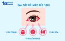 CÁCH PHÒNG BỆNH ĐAU MẮT ĐỎ (HƯỚNG DẪN CỦA BỘ Y TẾ)